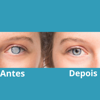 Antes-2-2.png