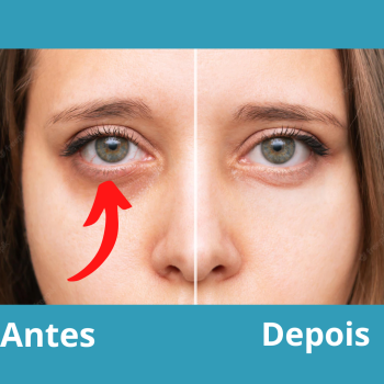 Antes-3-2.png