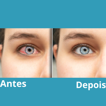 Antes-4-2.png